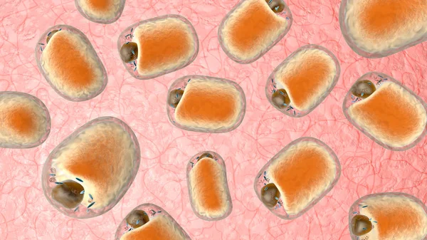 Vetcellen op menselijk weefsel — Stockfoto